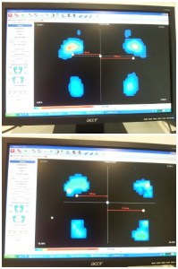 Revisión Podoactiva